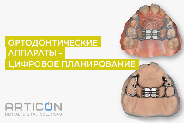 Ортодонтические аппараты - цифровое планирование. Индивидуальный курс (дата по запросу).