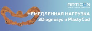 Немедленная нагрузка - 3Diagnosys и PlastyCAD