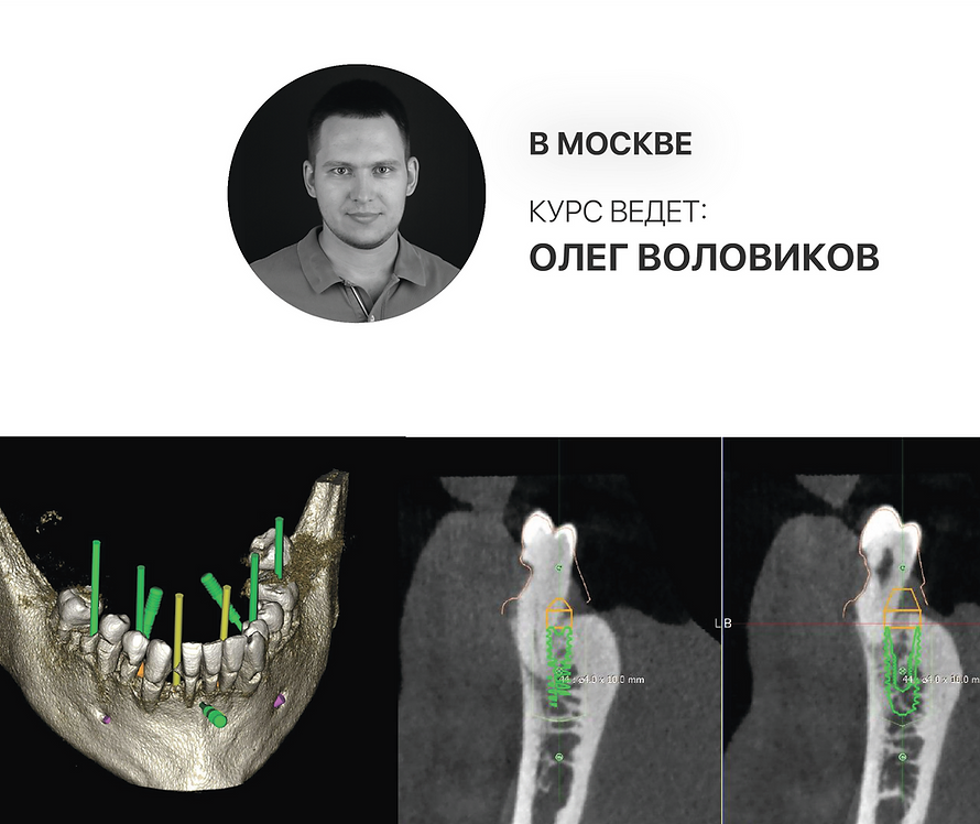 Навигационная хирургия