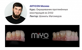 Окрашивание протяжённых конструкций из ZrO2 по принципу копирования индивидуальной характеристики зуба - MIYO